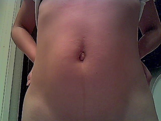 tummy tuck scars. Or I have to do Tummy Tuck?