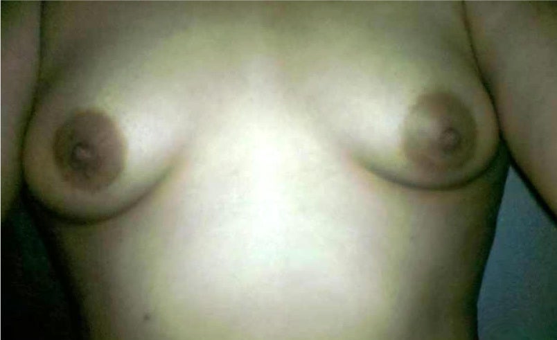 What I want is an implant that will give me cleavage, a C cup, natural look, 