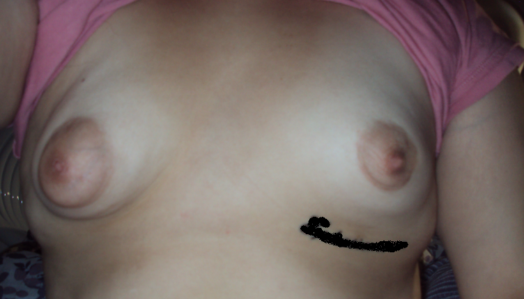 Can I Get Breast Implants if I Have a Tattoo Below my Breast boob tattoo