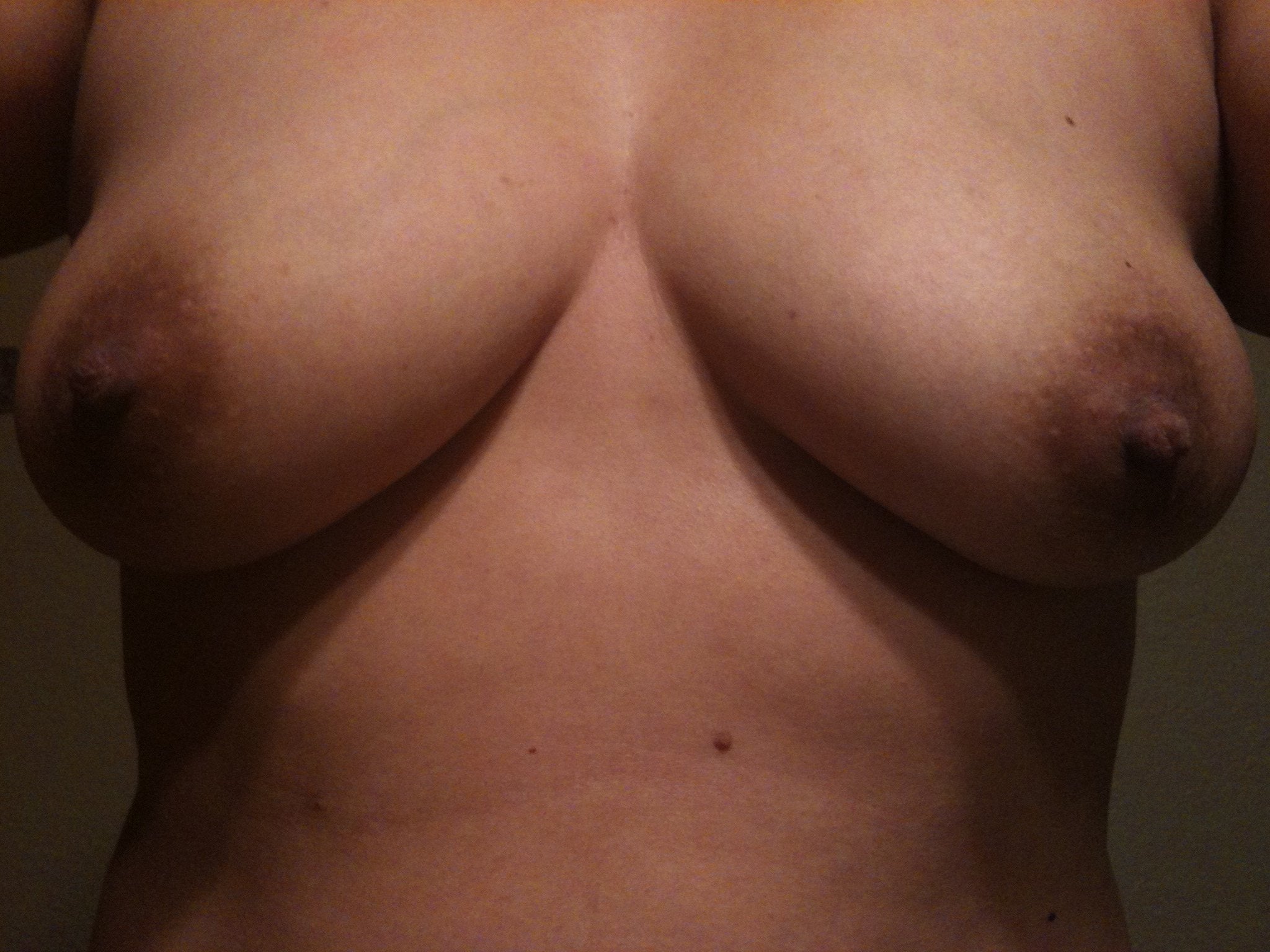 benelli breast augmentation