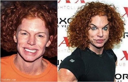 Carrot   Plastic Surgery on Carrot Top Plastic Surgery