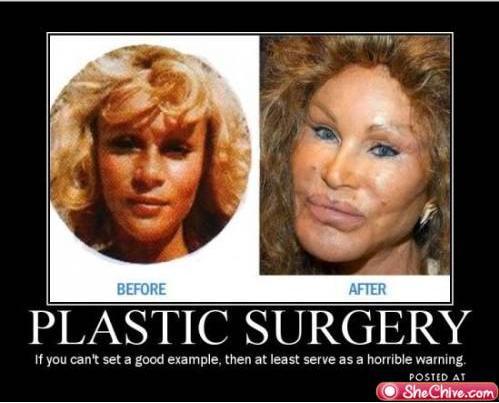 awful plastic surgery. Bad Plastic Surgery Catwoman