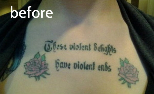 ... began tattoo removal in 2011 . This is her journey, in her own words