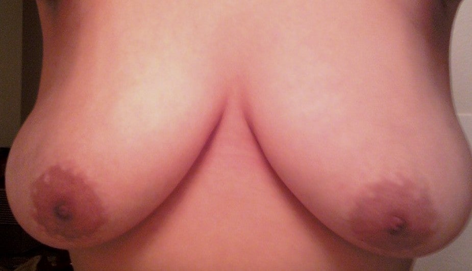  to Breast Reduction Lift and Implants to Get C Cups from DD Breasts