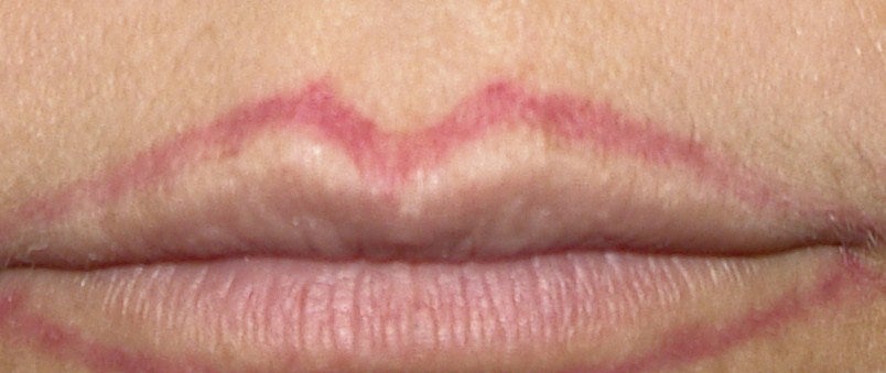 tattoo of lips. Also, could laser tattoo