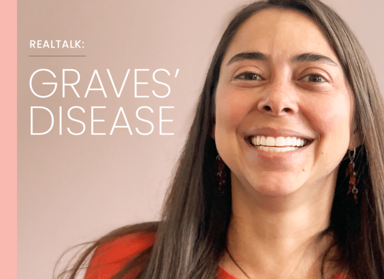 Graves’ Disease Affected Her Confidence. Eyelid Surgery Helped Restore