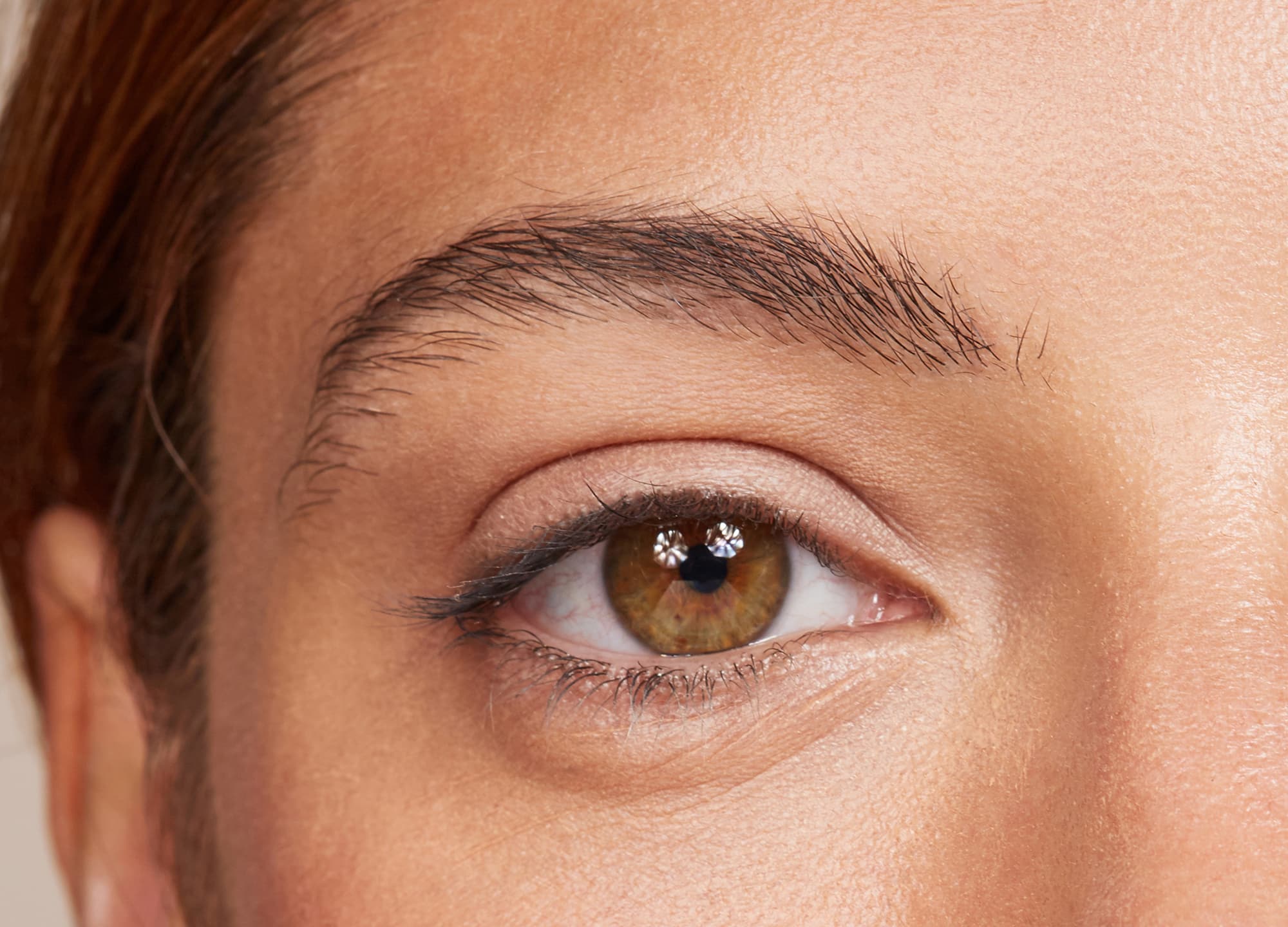 Life-saving Hacks to Get Rid of Dark Circles and Bags Under Your Eyes - For  Creative Juice