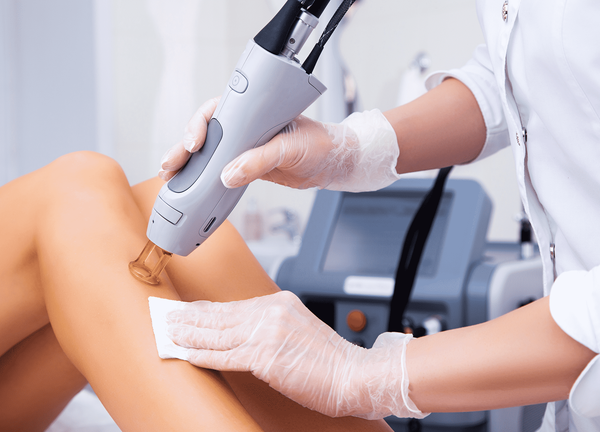 How Laser Hair Removal Left One Woman Scarred | RealSelf News