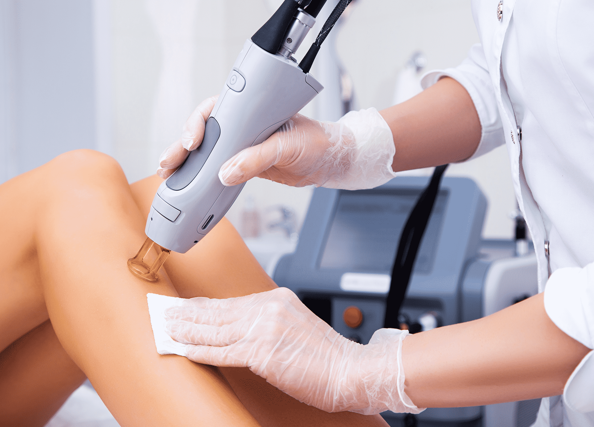 How Laser Hair Removal Left One Woman Scarred | RealSelf News How Laser Hair Removal Left One Woman Scarred | RealSelf News