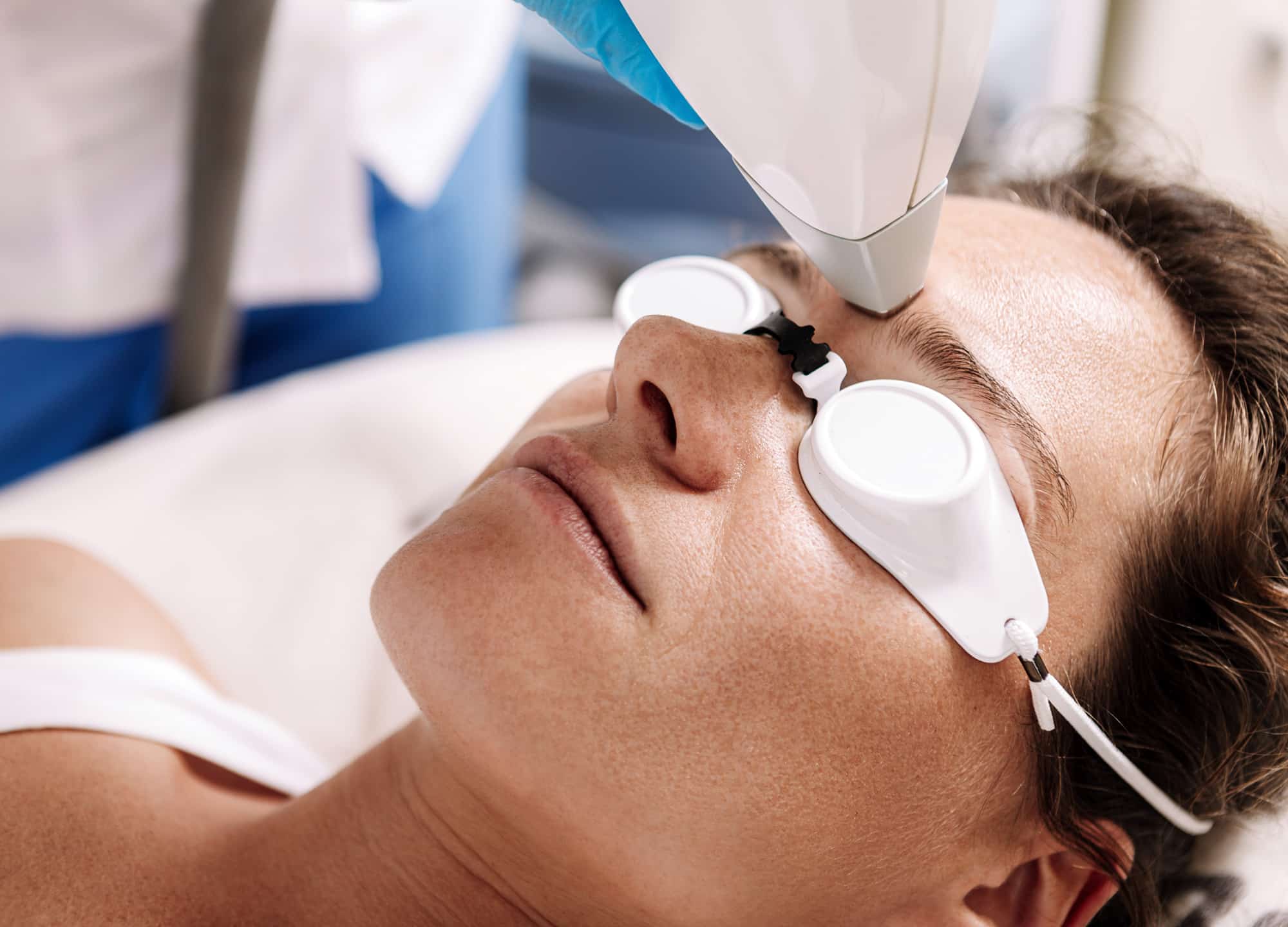 While speaking with your doctor pre-treatment is the best course of action, here are a few things to do before any laser treatment.