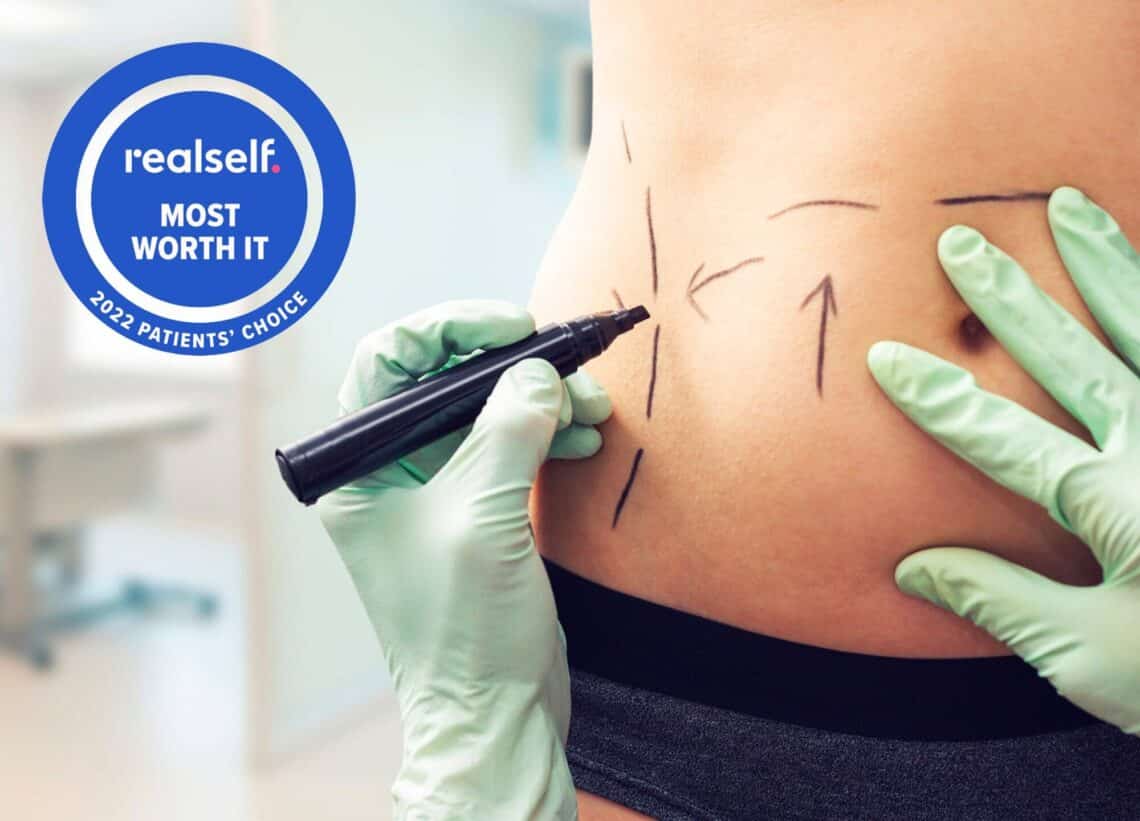 Tummy Tuck or Liposuction: What's the Difference? | RealSelf News