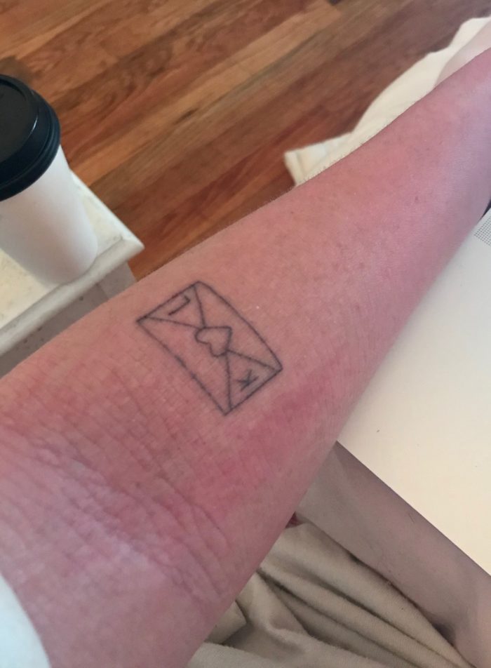 Netherton syndrome showing on the inner arm