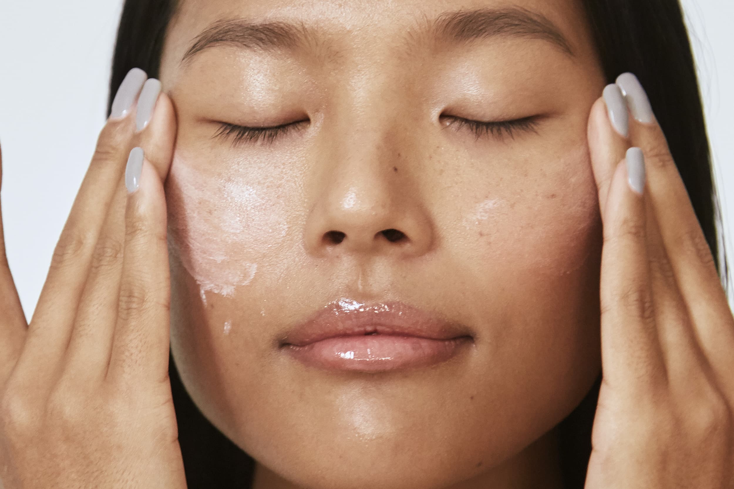 Hyperpigmentation Solutions For Every Skin Tone - RealSelf News