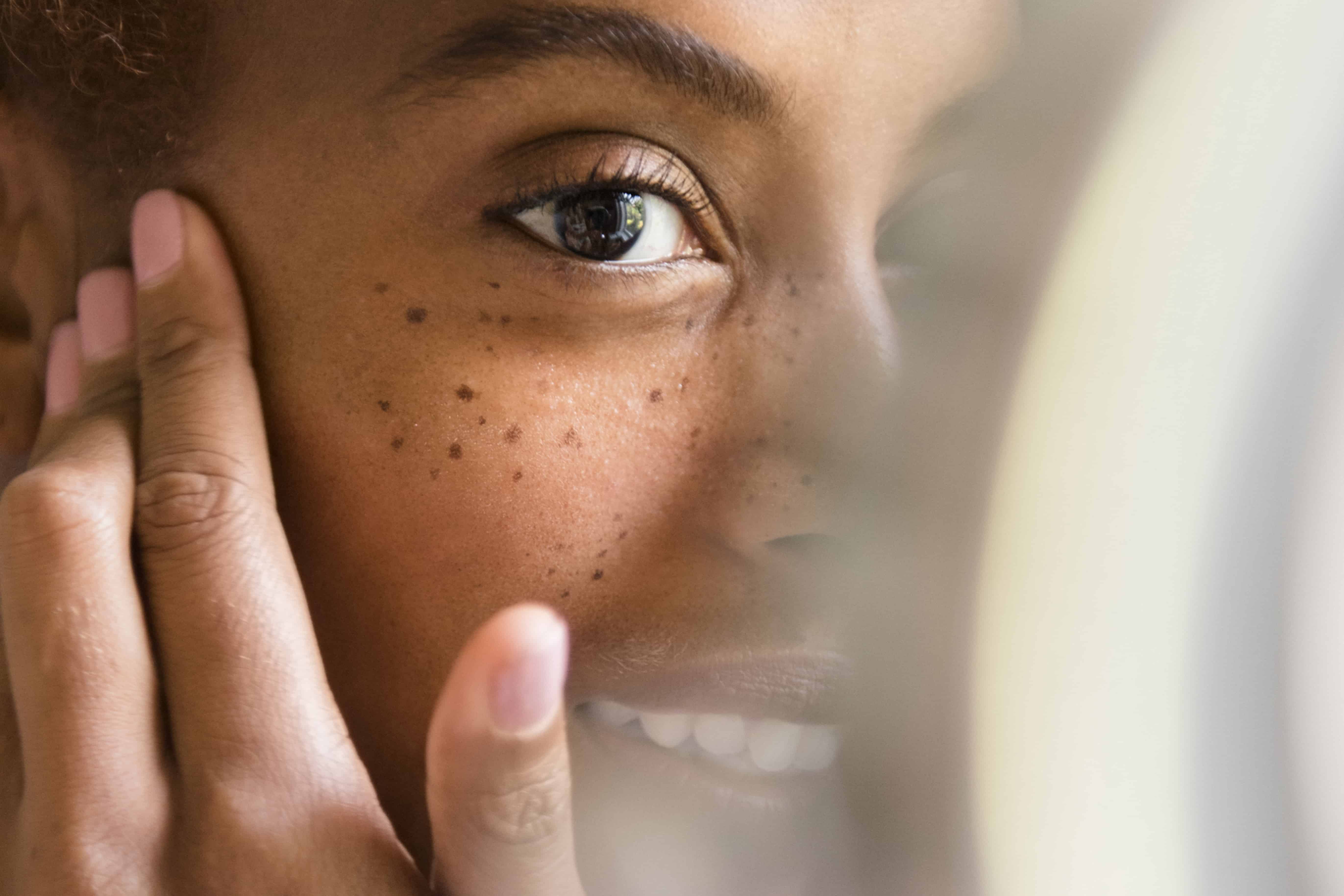 We asked four Black dermatologists to set the record straight on the most common myths and misconceptions around aesthetic treatments for dark skin.