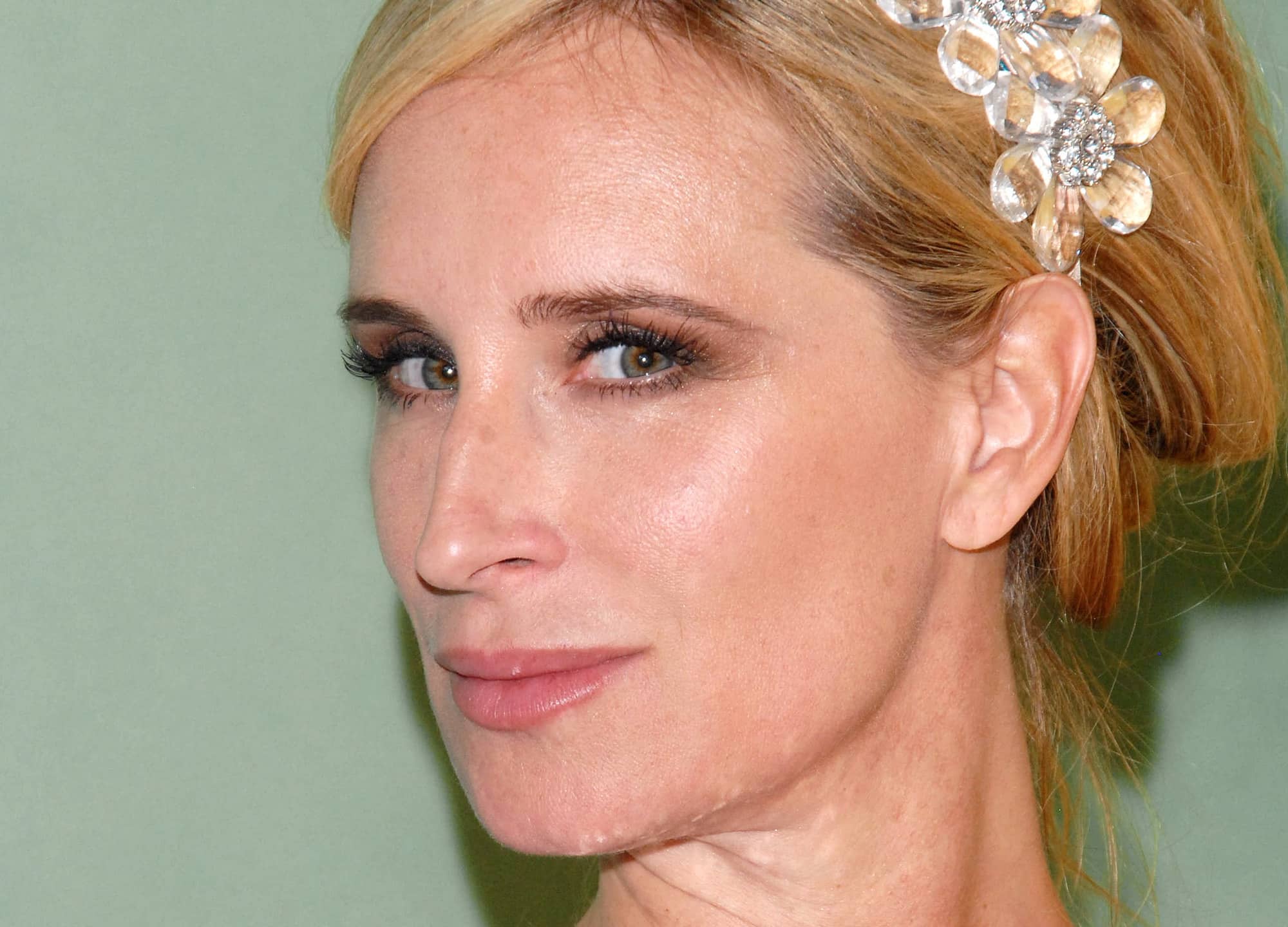 RHONY’s Sonja Morgan Debuts Facelift | RealSelf News
