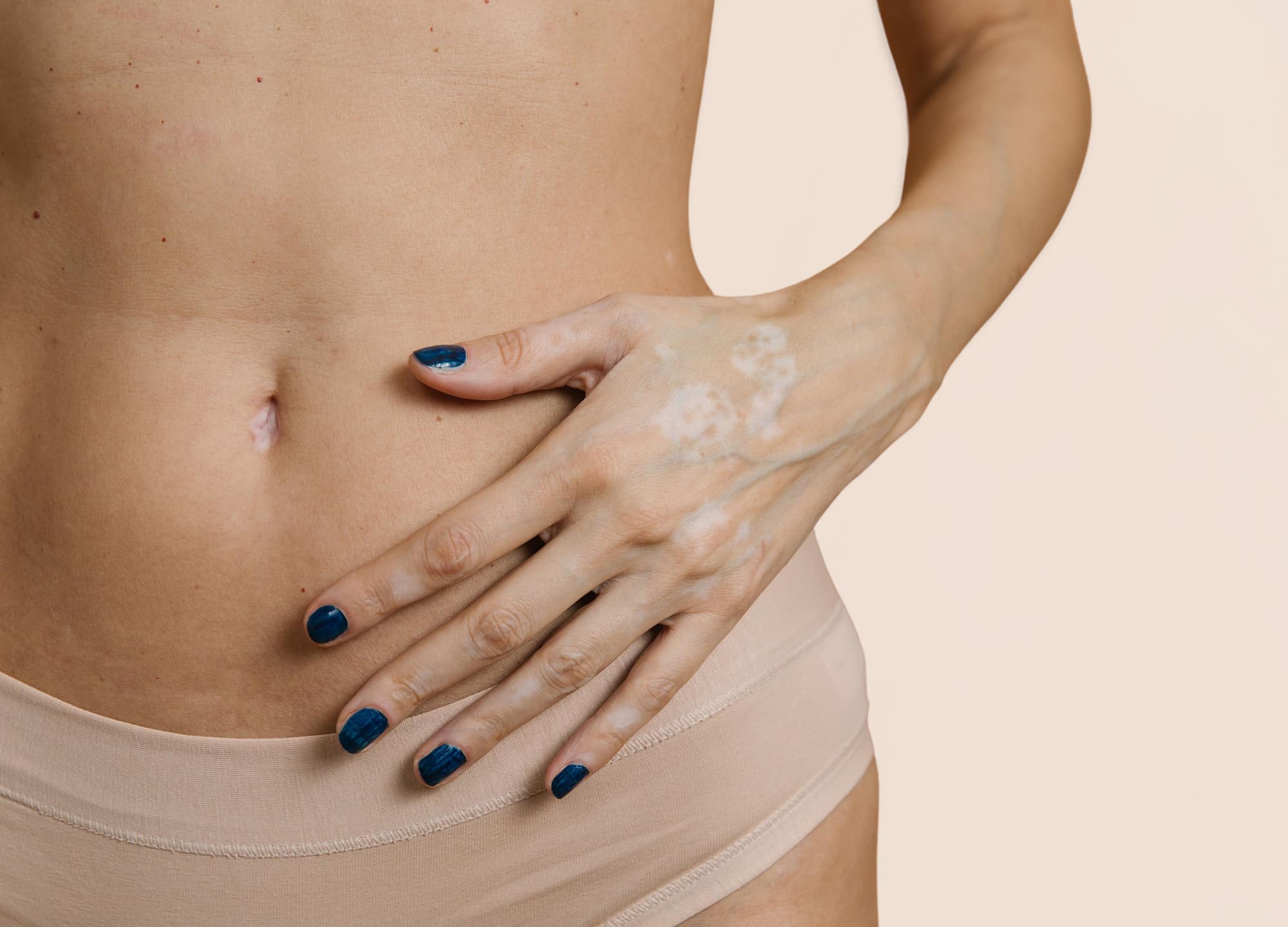 10 Things I Wish I Knew Before My Tummy Tuck