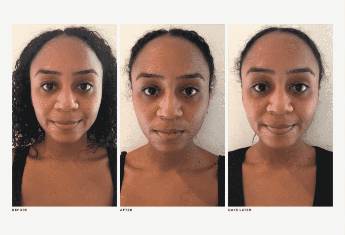 Clear + Brilliant results on black skin