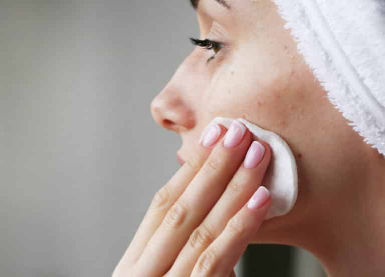 Post-acne hyperpigmentation is very common, but most people don't know the causes or treatment options. Here's what you need to know.