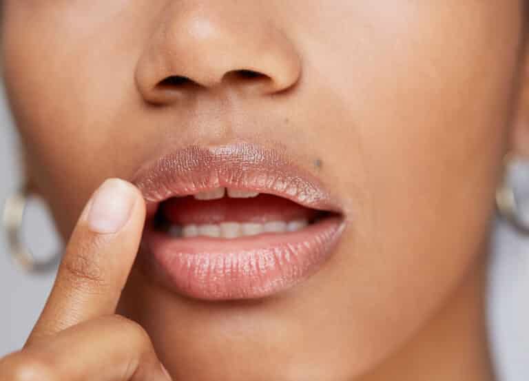 Learn everything you need to know about LipLase, the noninvasive treatment for bigger lips, without filler.