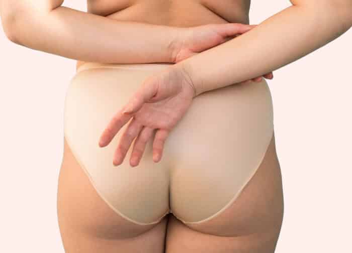 Liposuction