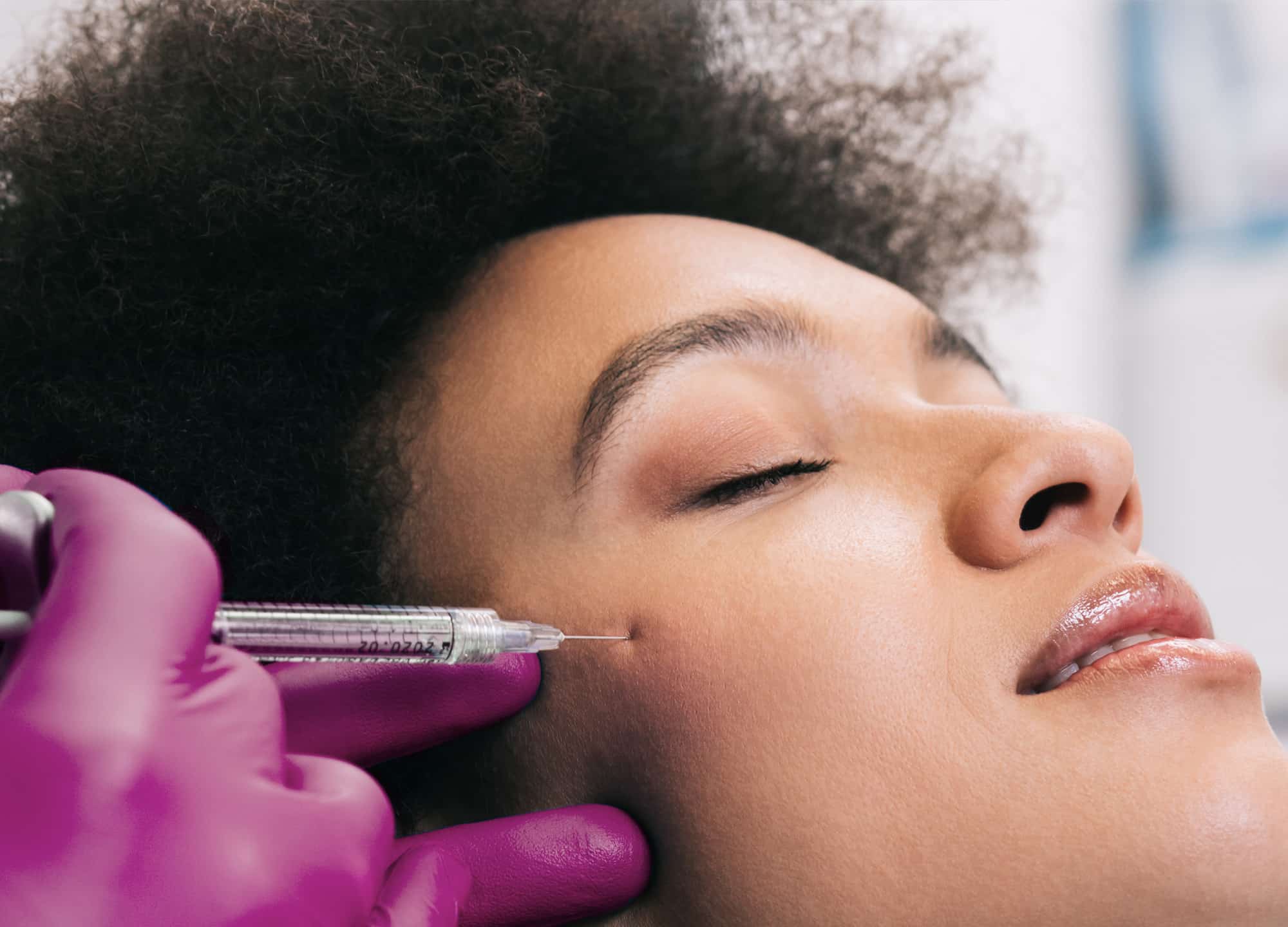 The resilient hyaluronic acid (RHA) fillers are available in four different versions. Here’s what you need to know before trying RHA Collection.