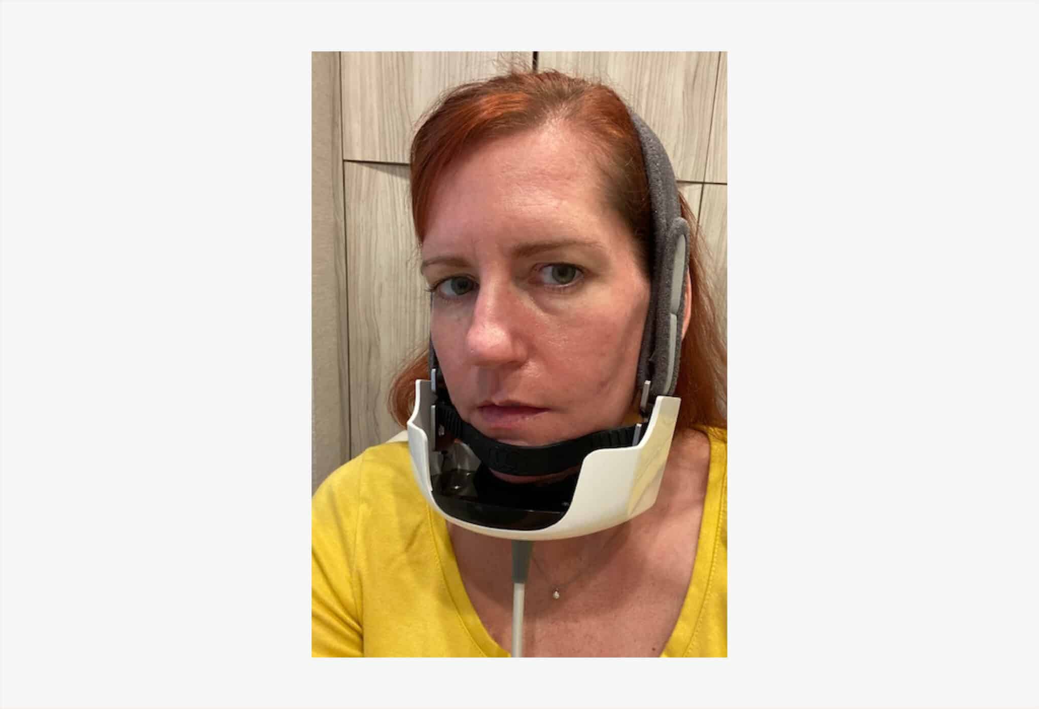 I Tried the New Evoke FaceTightening Treatment RealSelf News