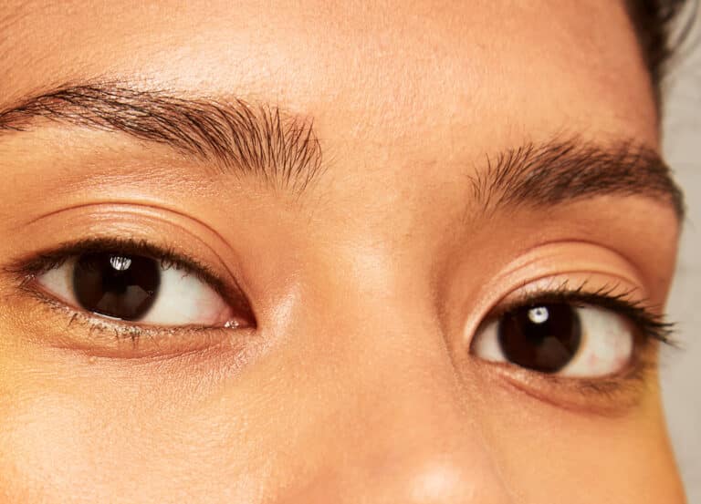 Eyelid surgery is proving to be a reliable fix for a slew of age-irrelevant eye-area concerns. Learn more about the top reasons younger patients are getting blepharoplasty.