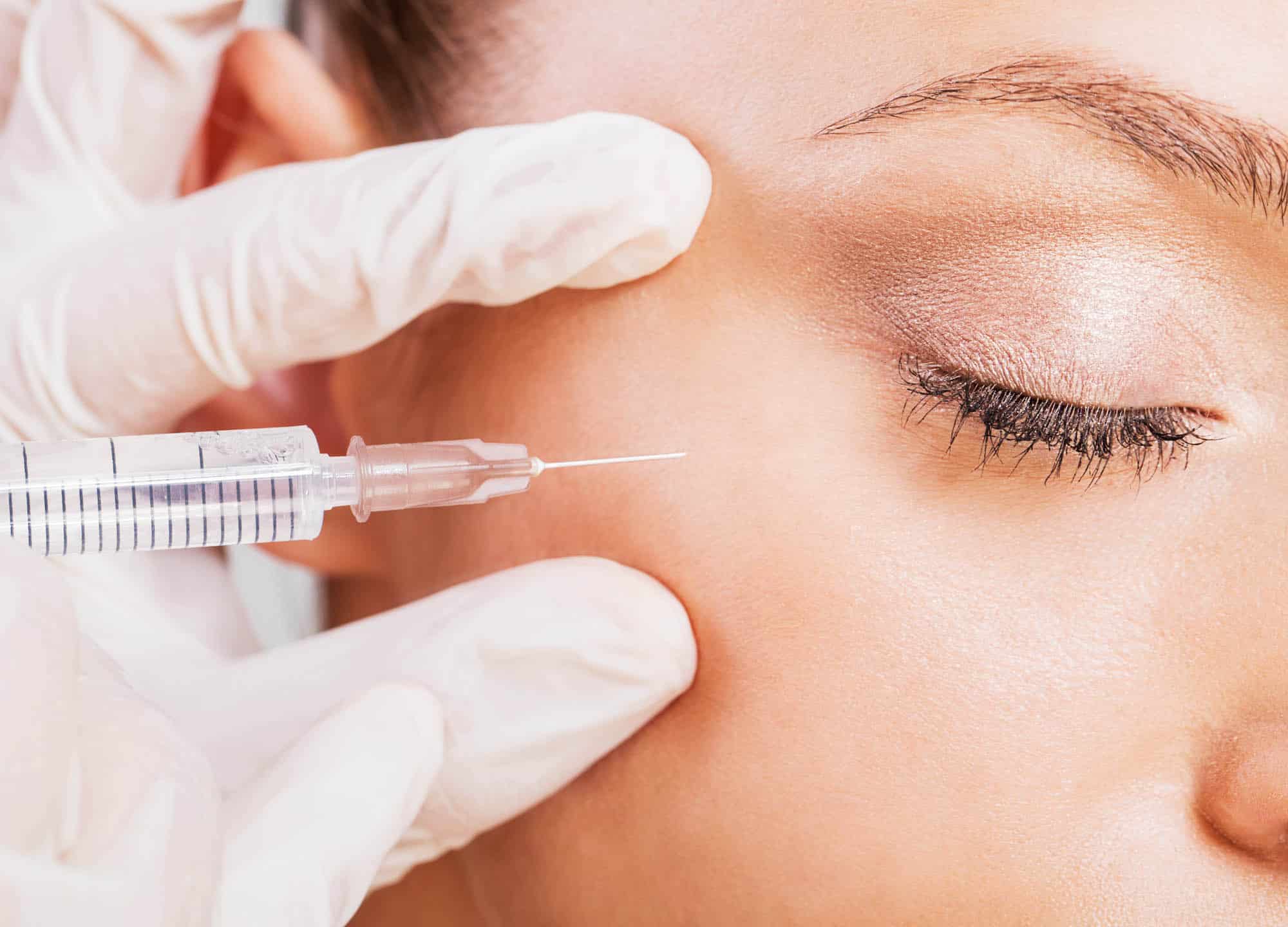 Good Under-Eye Filler Results: 4 Things to Always Look For | RealSelf News