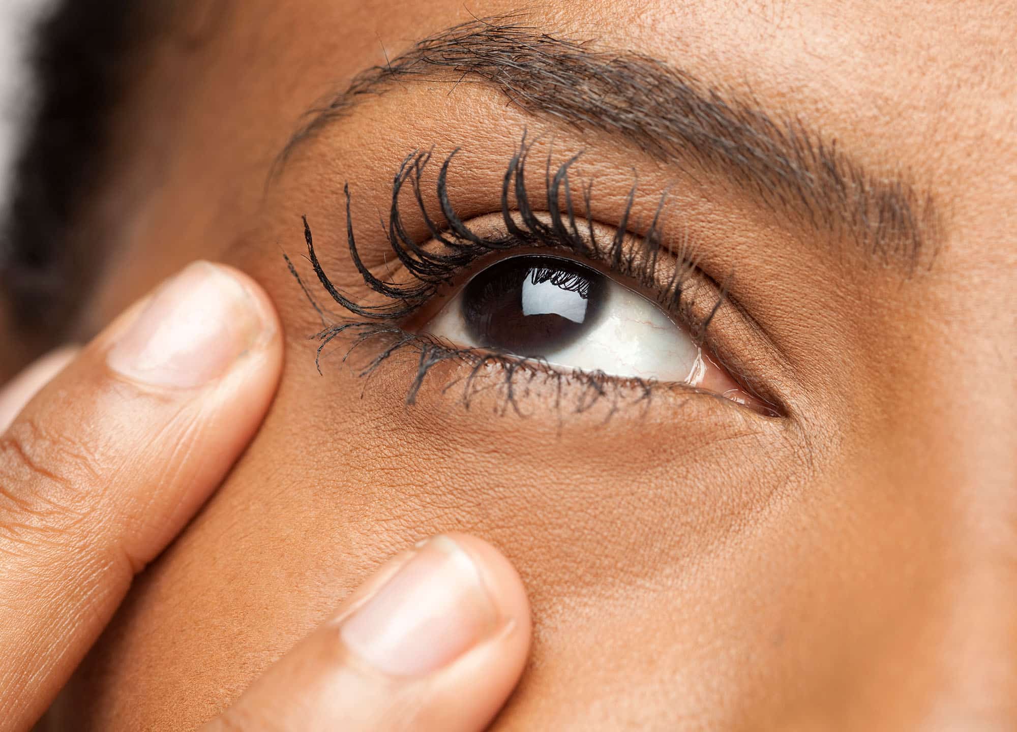 Puffy Eyes and Bags with Eyelid Surgery