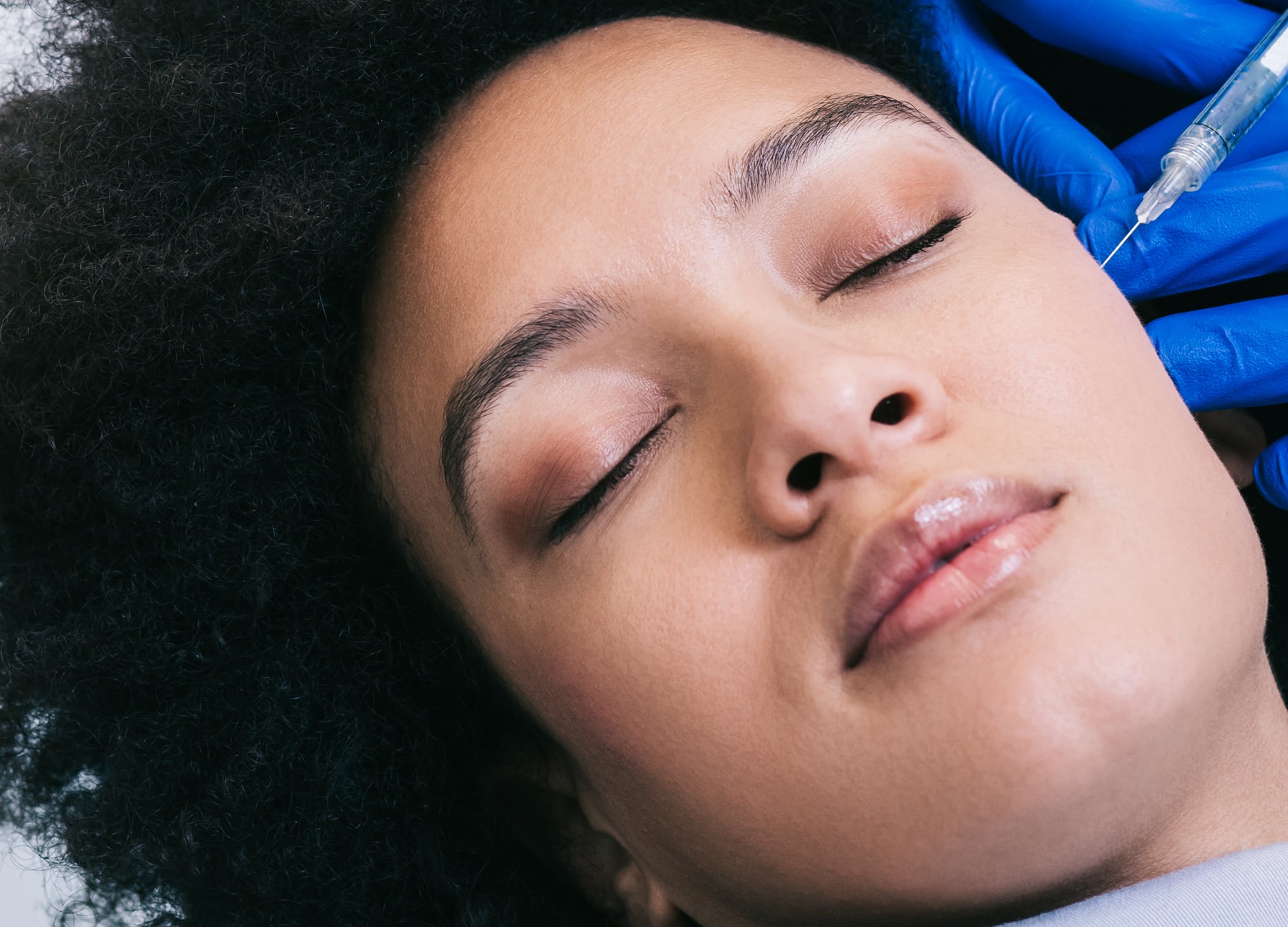 3 people in the Moderna COVID-19 vaccine trial saw swelling around their fillers. Here’s why dermatologists say it’s nothing to worry about.