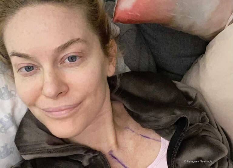We caught up with Leah McSweeney to chat about her recent procedures and why she thinks it’s important to be up-front about cosmetic work.