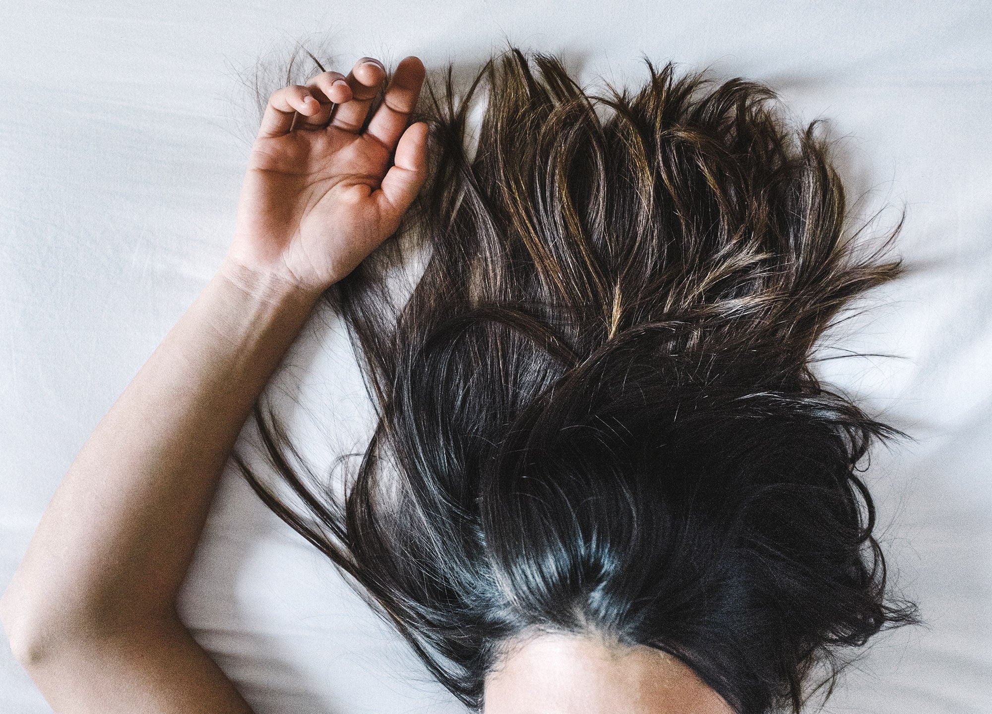 I Tried PRFM Injections for Hair Loss | RealSelf News I Tried PRFM Injections for Hair Loss | RealSelf News