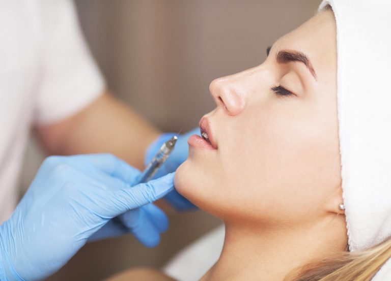 Should you be concerned about lip filler migration? Here’s what you need to know, including what filler migration is, where it occurs and more.