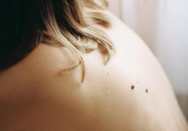 Dermatologists share five questions to ask your doctor before basal cell or squamous cell carcinomas, or melanoma skin cancer surgery.