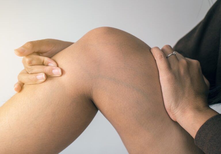 Gone are the days of surgical vein-stripping. Common procedures include radiofrequency ablation, heat treatments, and shutting off blood flow.