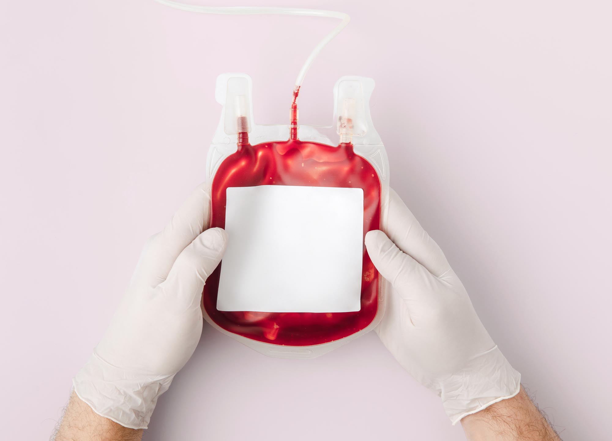Some plastic surgeons have started to integrate a special form of technology into their operations: cell savers.