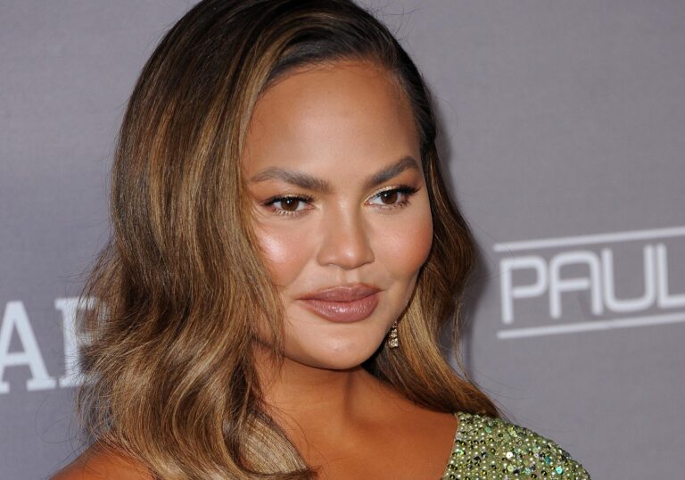 In Chrissy Teigen’s recent round of Instagram stories, she revealed a more sculpted face, thanks to buccal fat removal.