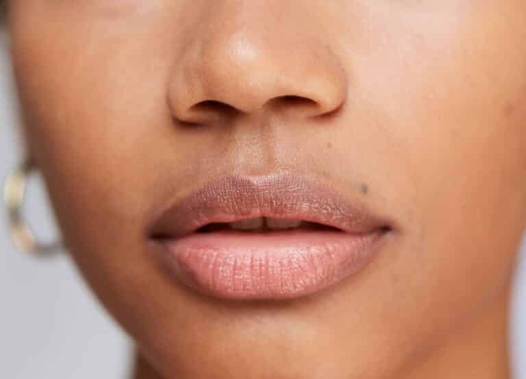 Our facial plastic surgeons share key aspects to look for in lip lift before-and-after results.