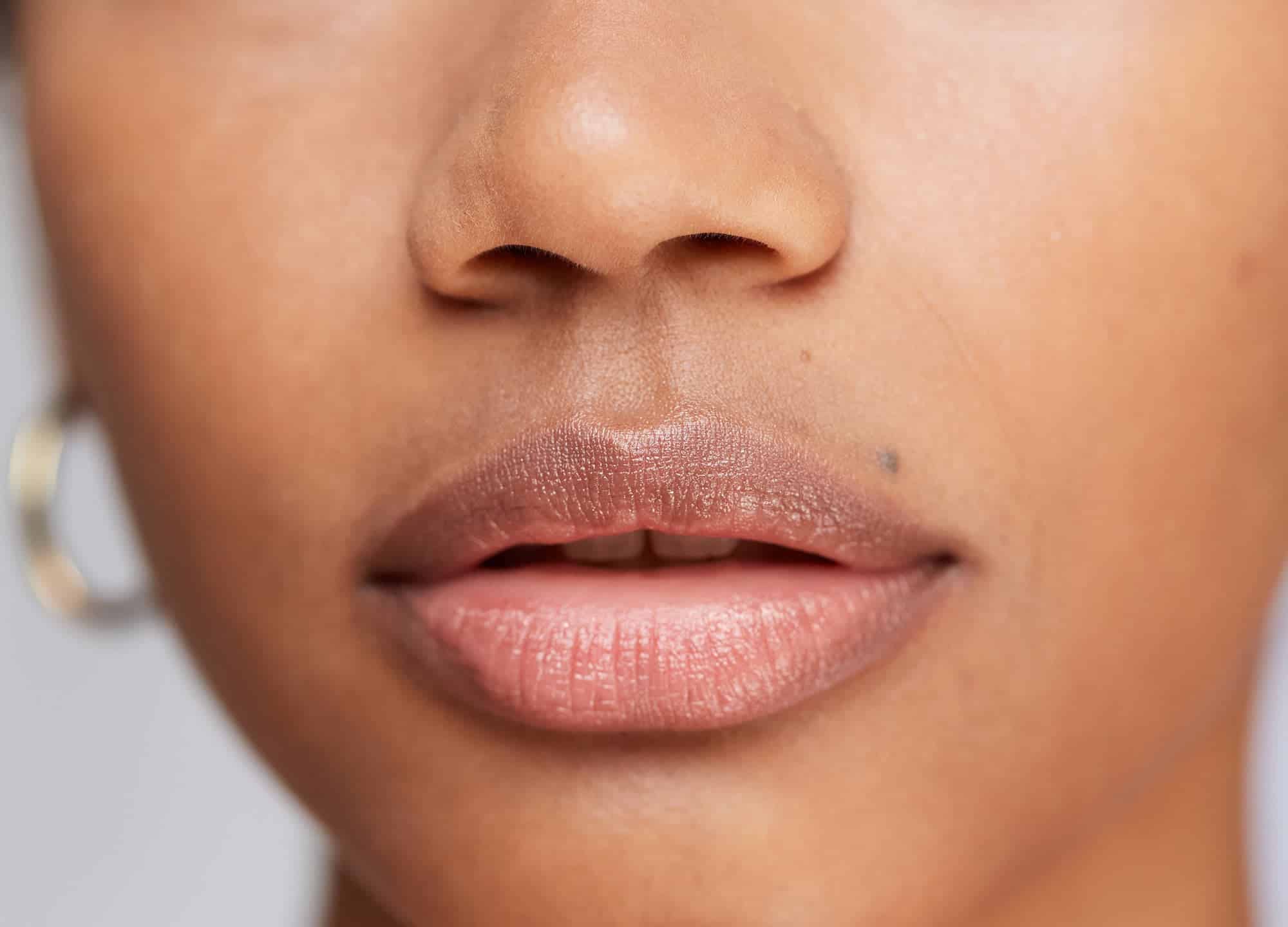 What Is a Lip Lift? Doctors Explain the Plastic Surgery Procedure That  Could Replace Lip Filler