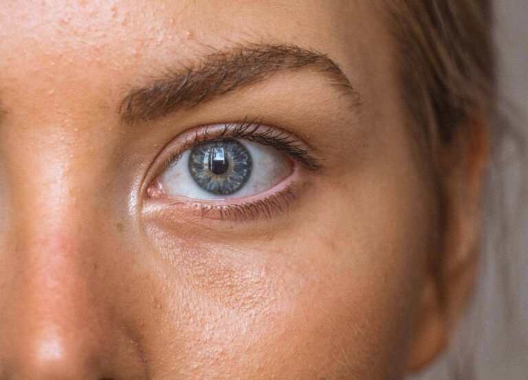 Under-eye filler isn’t for everyone. Experts share the best filler-free solutions for common eye-area concerns.