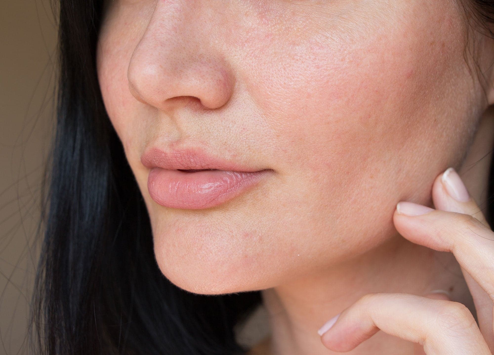 Two dermatologists clue us in on everything you need to know about managing and treating eczema. Learn more.