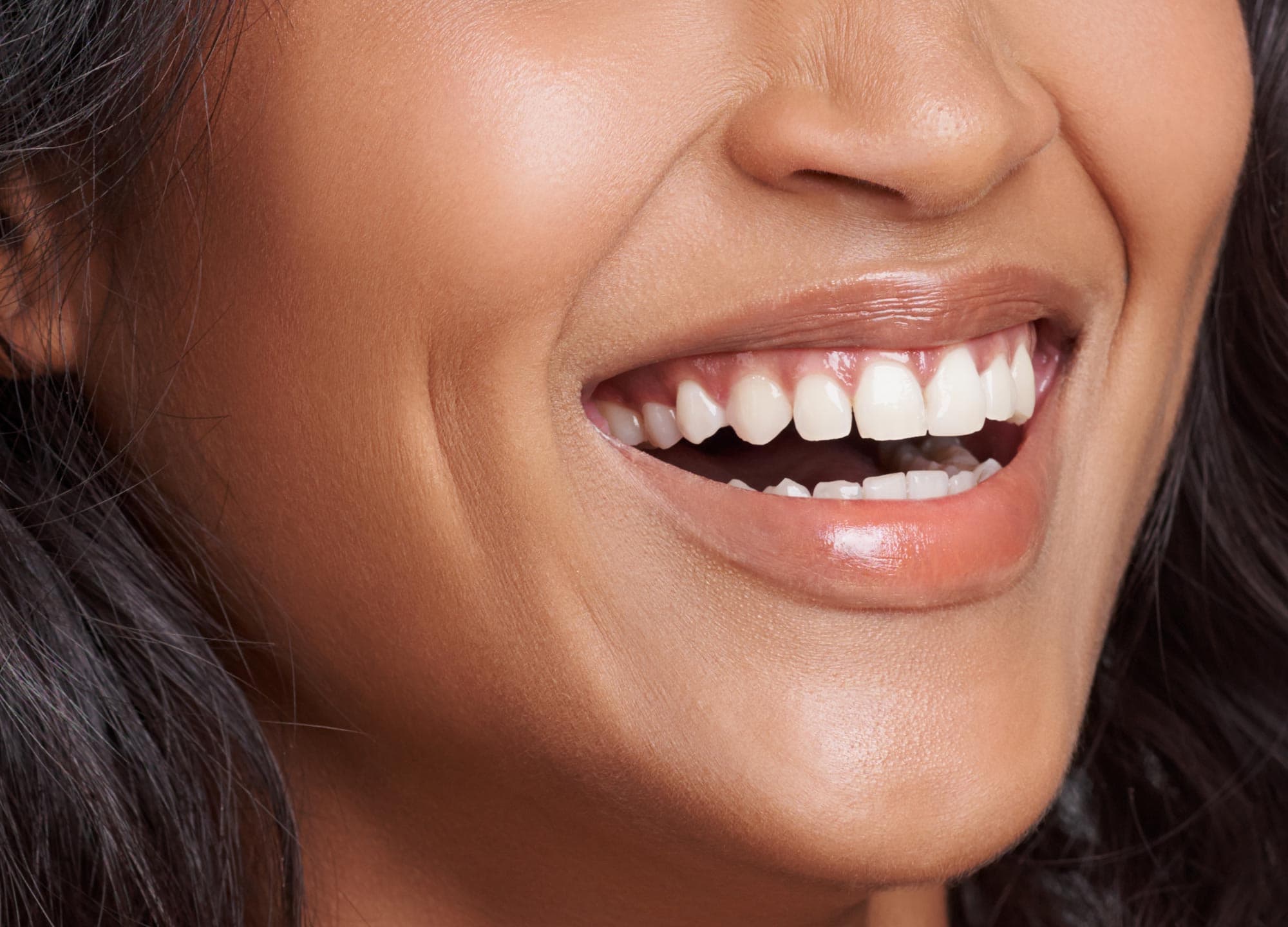 Can you kiss someone with invisalign?