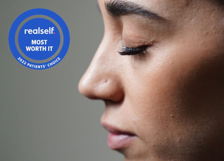 Side view of woman's nose - rhinoplasty results