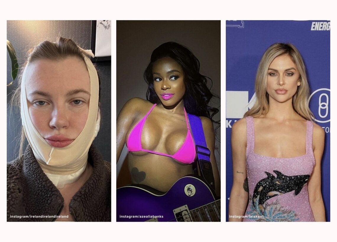 Aesthetic News: Azealia Banks, New BBL Guidelines | RealSelf News