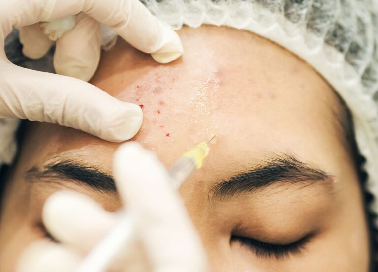 Close up of woman receiving Botox injections for acne treatment