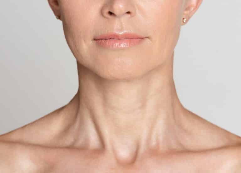 Close up of woman's neck with neck bands which can be treated by neck Botox