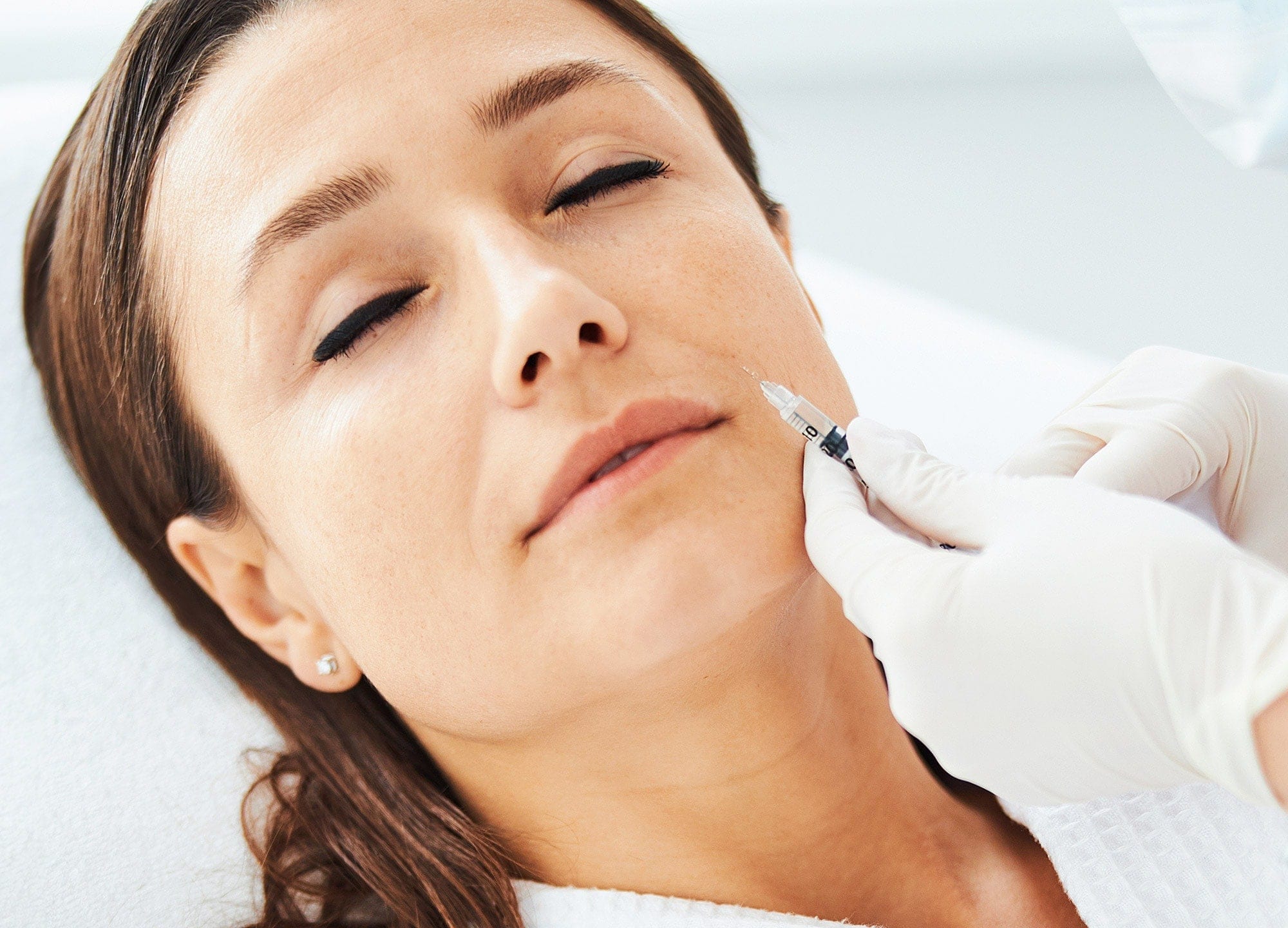 Woman getting filler injected into nasolabial folds