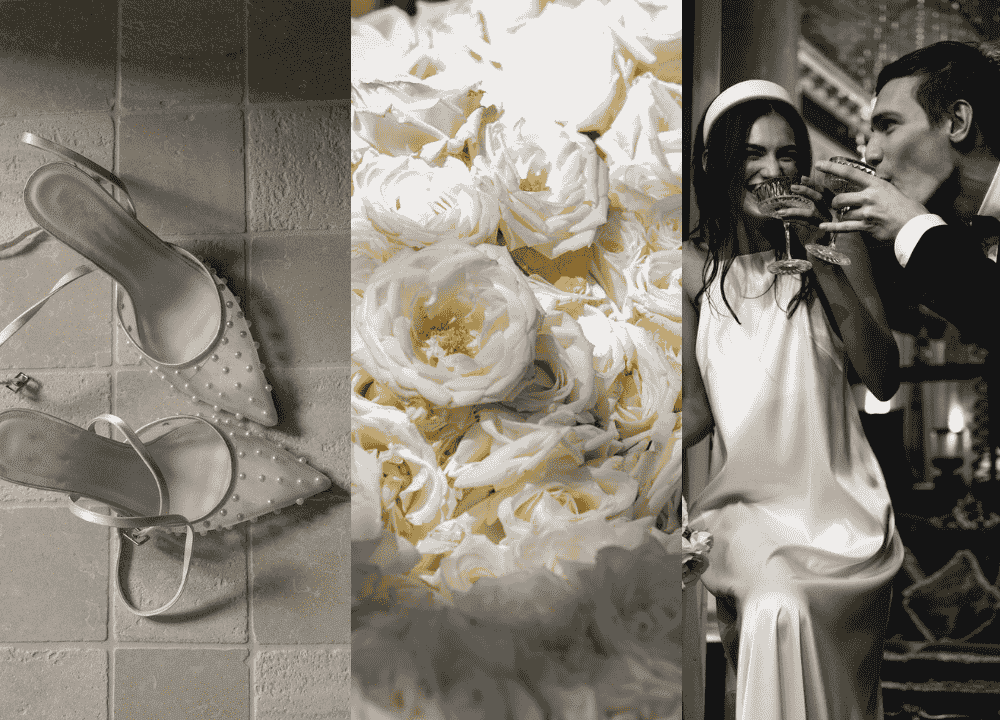 Wedding Treatment Timeline