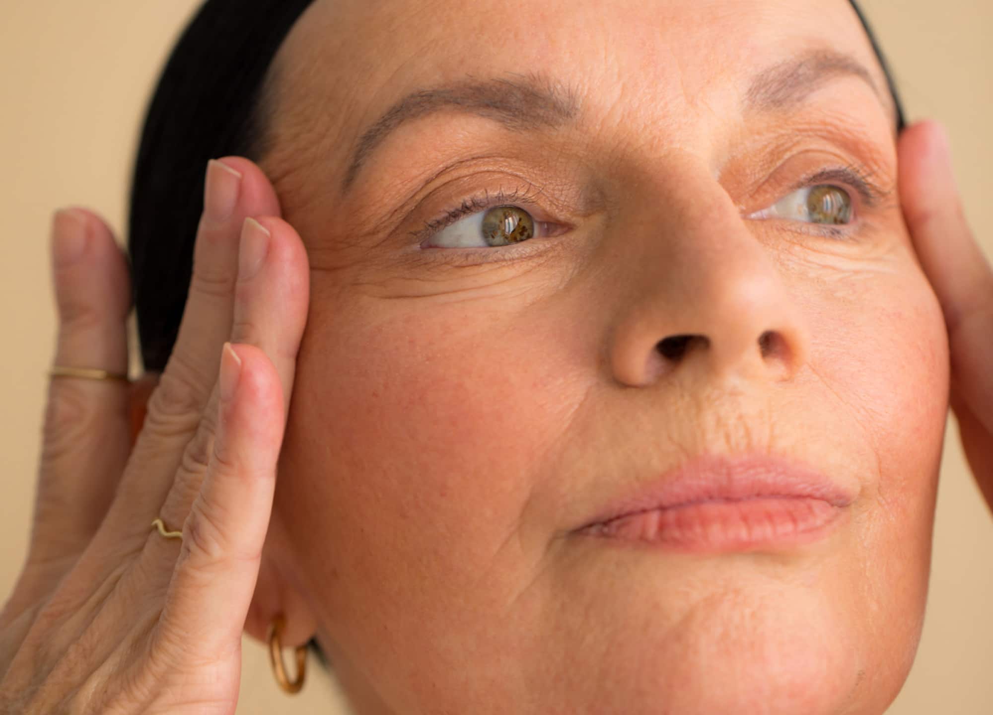 Botched facelift on sale