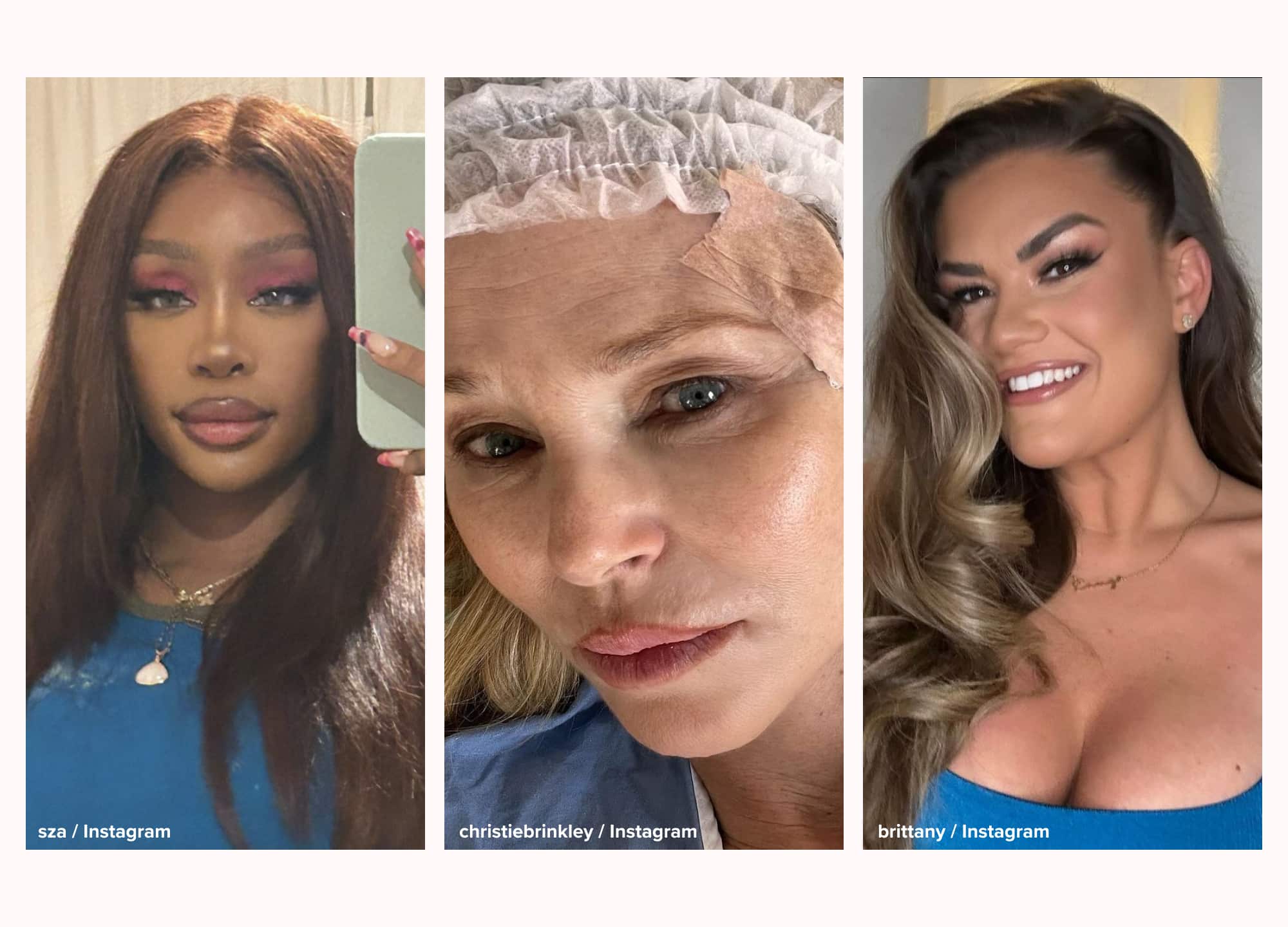 This Month in Aesthetics: SZA Removes Her Breast Implants, Filler Gets a New FDA Approval, Christie Brinkley's Surgery, and More - article image